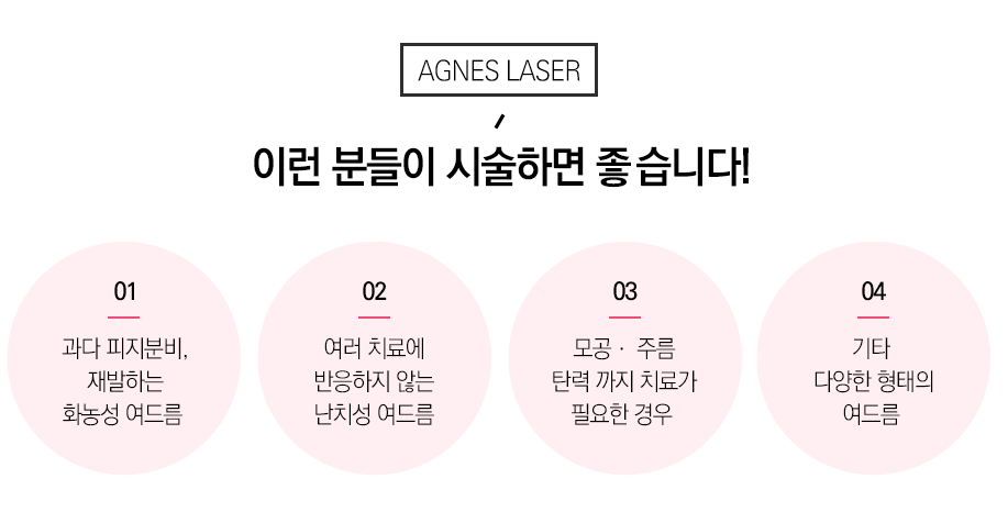 아그네스 매끄러운 결을 관련 이미지 6