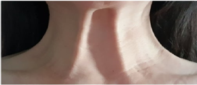 저도 이제 목주름이 생기네요??(전원장 목주름극뽁 프로젝트) 관련 이미지 4