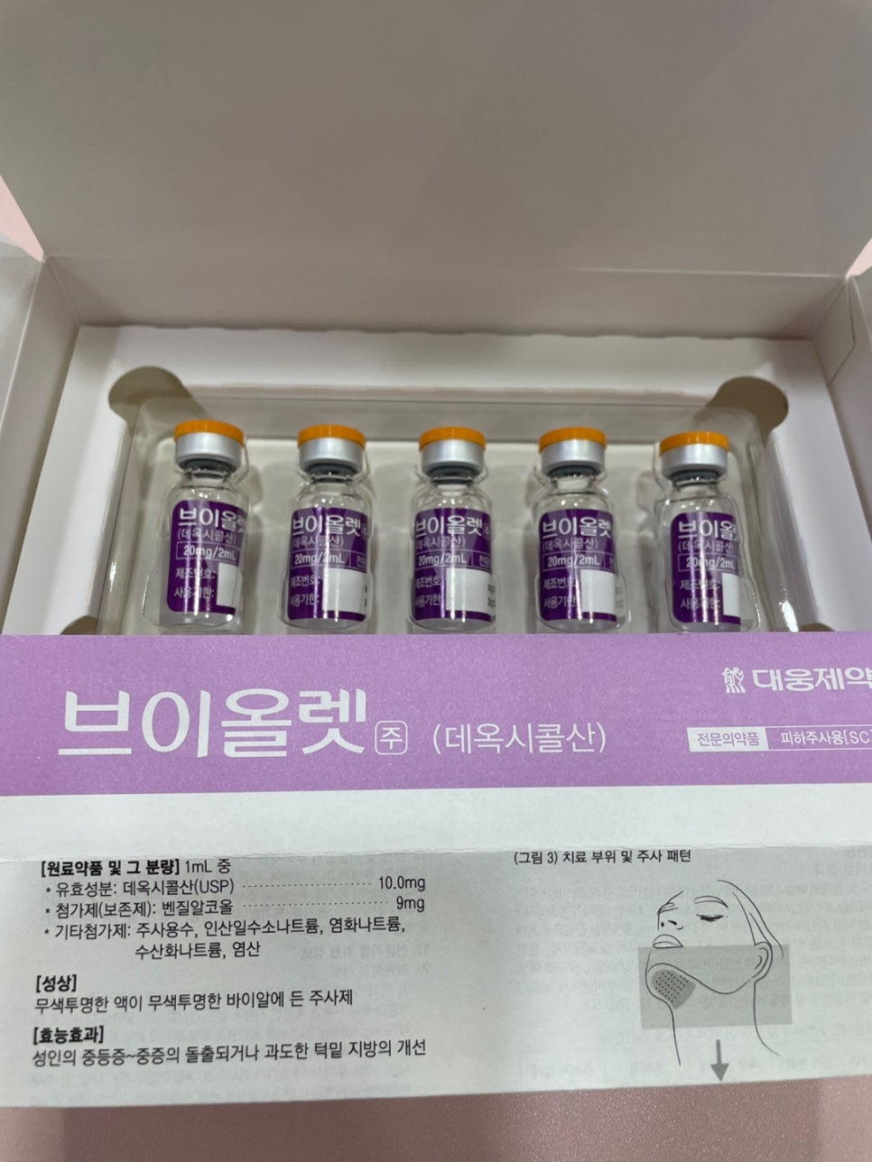 이중턱 없애는 브이올렛 시술 제가 받아봤습니다 관련 이미지 2