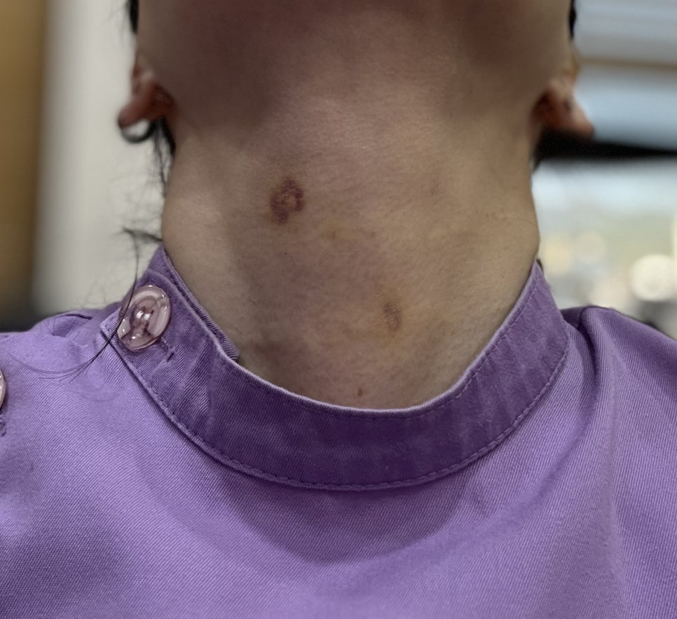 저도 이제 목주름이 생기네요??(전원장 목주름극뽁 프로젝트) 관련 이미지 5