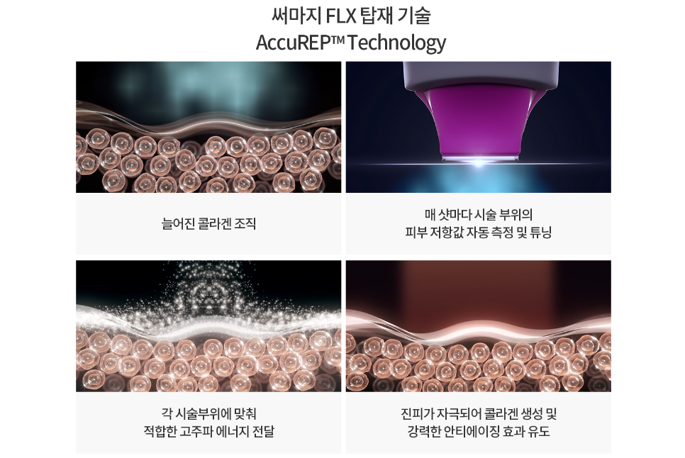 써마지 FLX로 더 탄력 있는 피부가 되세요 관련 이미지 5