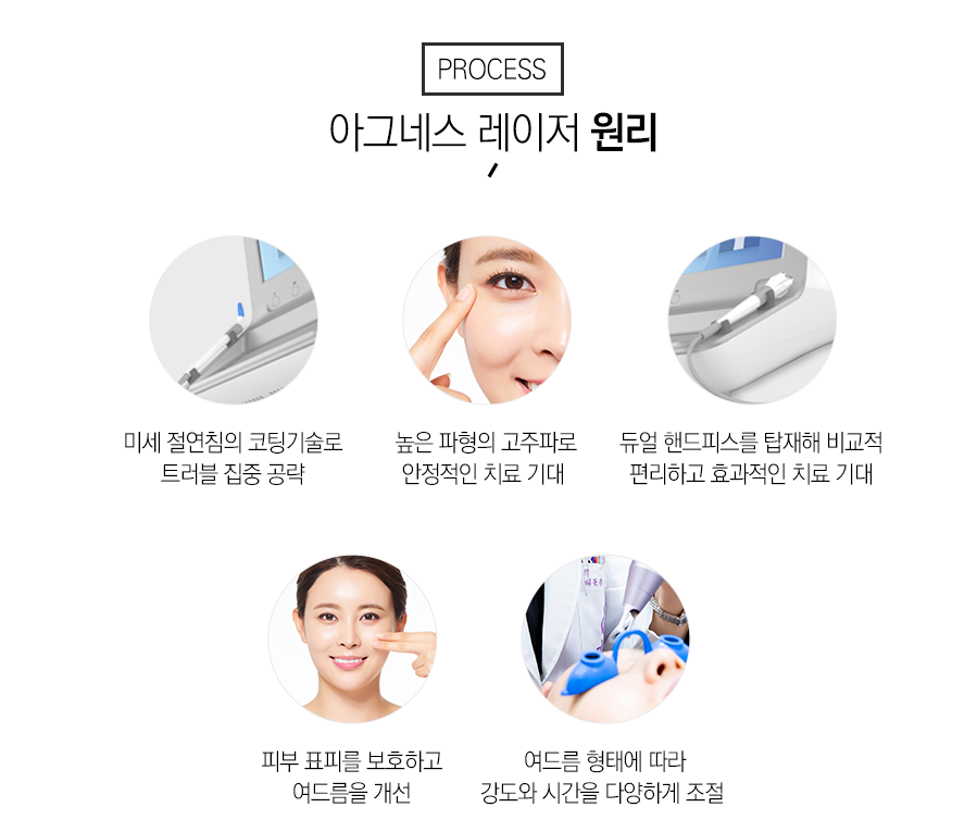 아그네스 매끄러운 결을 관련 이미지 7