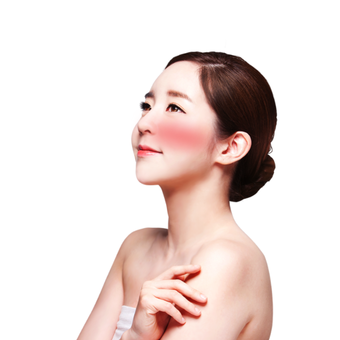 수시로 붉어지는 안면홍조 치료가능할까? 관련 이미지 1