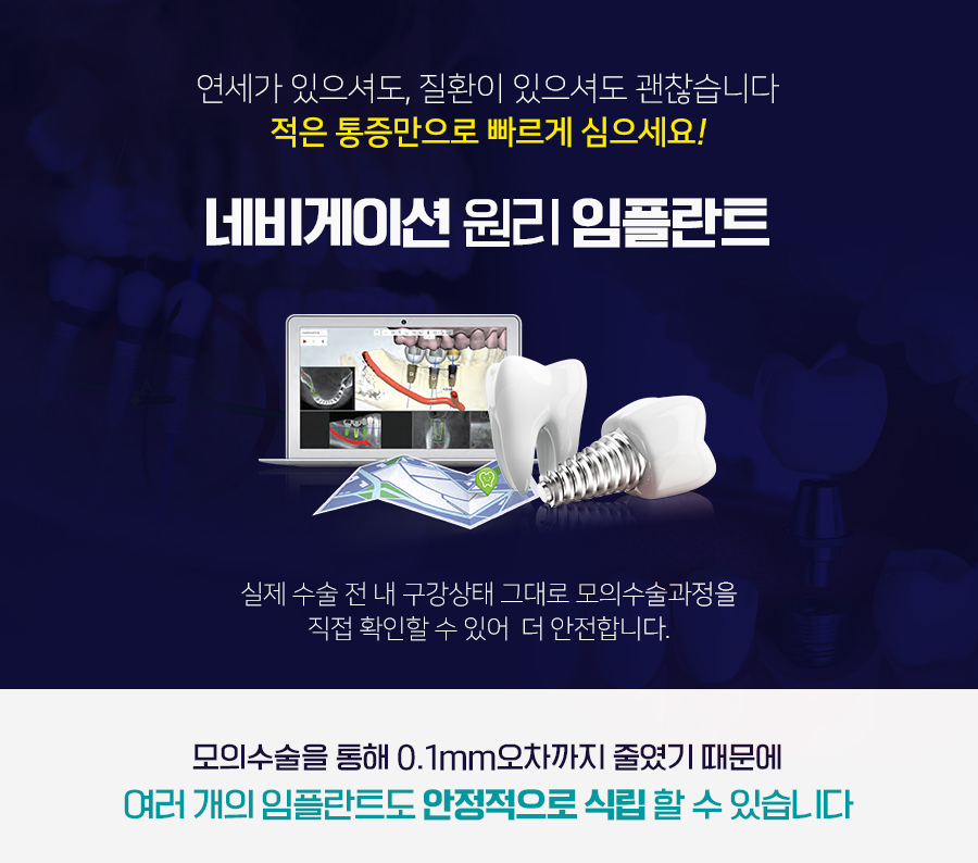 치료기간 걱정 덜어주는 당일임플란트 관련 이미지 4