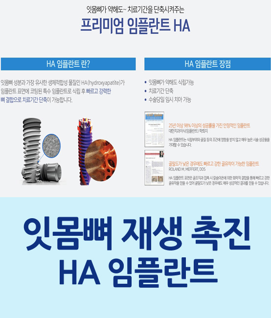 임플란트 고민, 잇몸뼈 재생 촉진하는 HA임플란트로 해결하세요 관련 이미지 1