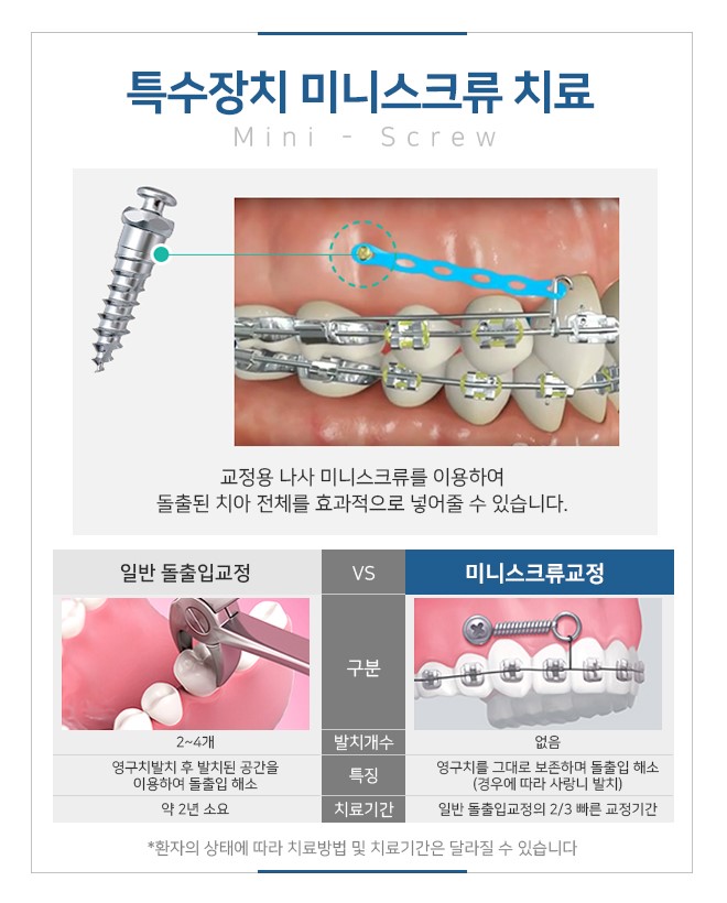 명동치과에서 비발치교정 시작해 보세요 관련 이미지 4