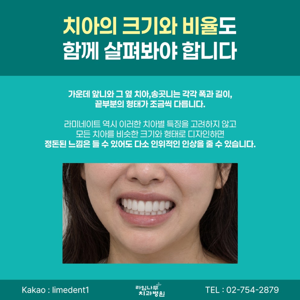 명동 라미네이트 전 꼭 확인해야 할 자연스러운 치아 디자인 기준 관련 이미지 4