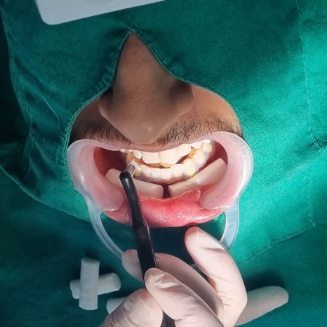 사우디아라비아에서 오신 압둘라 씨가 라임나무치과를 찾아 주셨어요! 관련 이미지 4