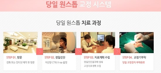 덧니의 정의와 덧니 교정방법 관련 이미지 10