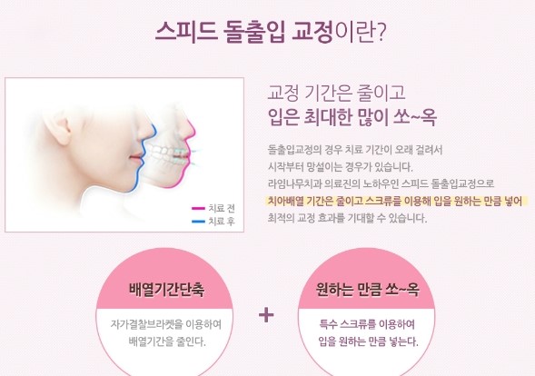 돌출입의 정의와 돌출입 교정에 대한 모든 것을 공개합니다 관련 이미지 6