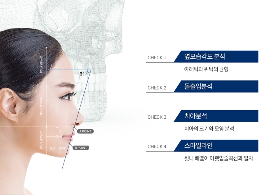 [주걱턱 무턱 돌출입] 치아교정의 선택기준 관련 이미지 5