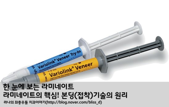 한 눈에 보는 라미네이트 : 라미네이트의 핵심! 본딩(접착)기술의 원리 관련 이미지 1