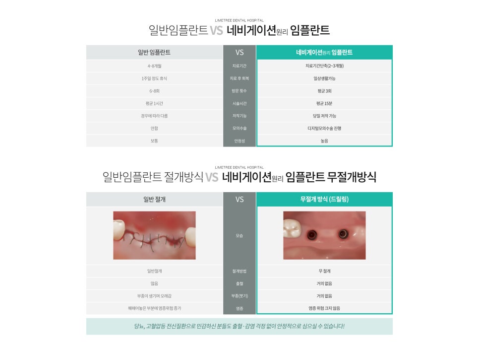 라임나무치과 네비게이션 임플란트! 자세히 알아보기 :) 관련 이미지 5