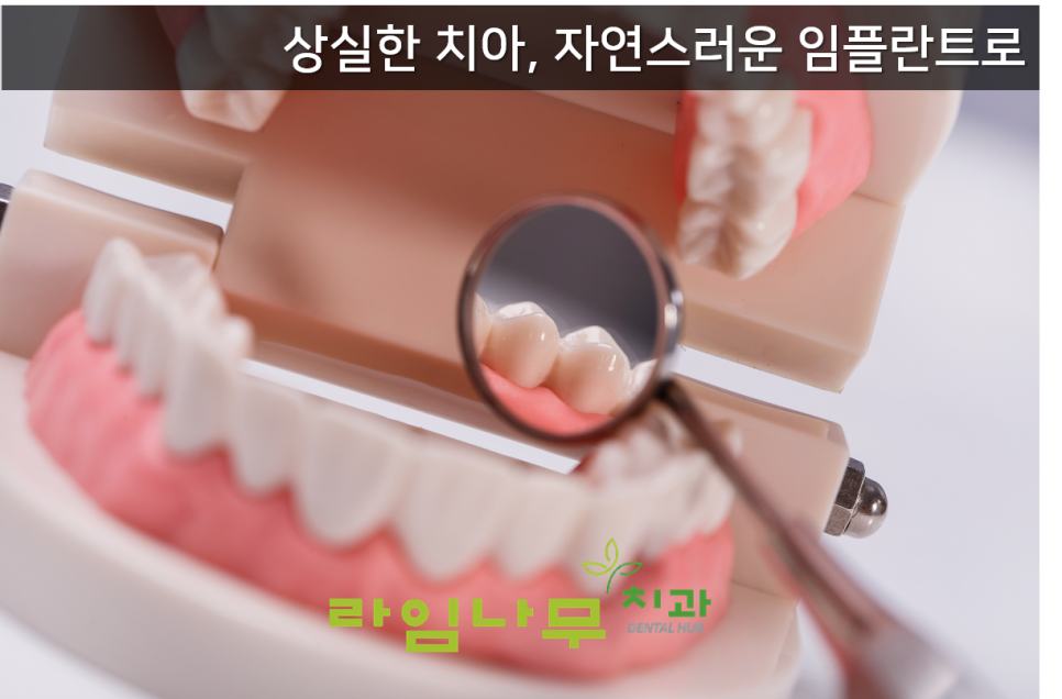고혈압 임플란트 가능여부? 명동치과 라임나무치과 관련 이미지 4