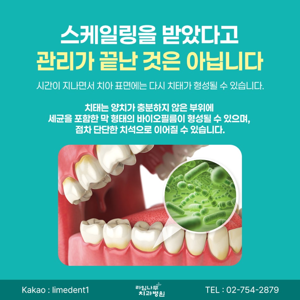 Why Your Teeth May Feel Sensitive After Scaling at a Myeongdong Dental Clinic and How to Care for Them image 6