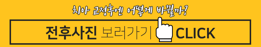 치아교정 시작 전, 알아둬야 할 체크포인트 관련 이미지 10