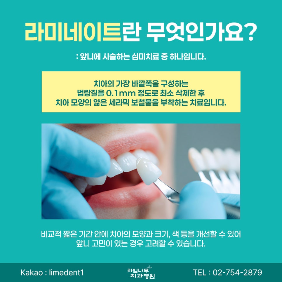 라미네이트 치료, 신중한 결정이 중요합니다 관련 이미지 3