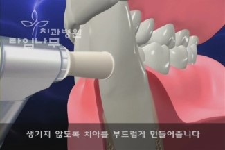 스케일링 건강보험 혜택 명동치과에서 7월부터 꼭 챙기세요 ^^ 관련 이미지 5