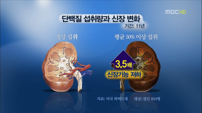 단백질 섭취 가이드, 하루에 체중 0.1%가 좋다고 합니다 관련 이미지 3