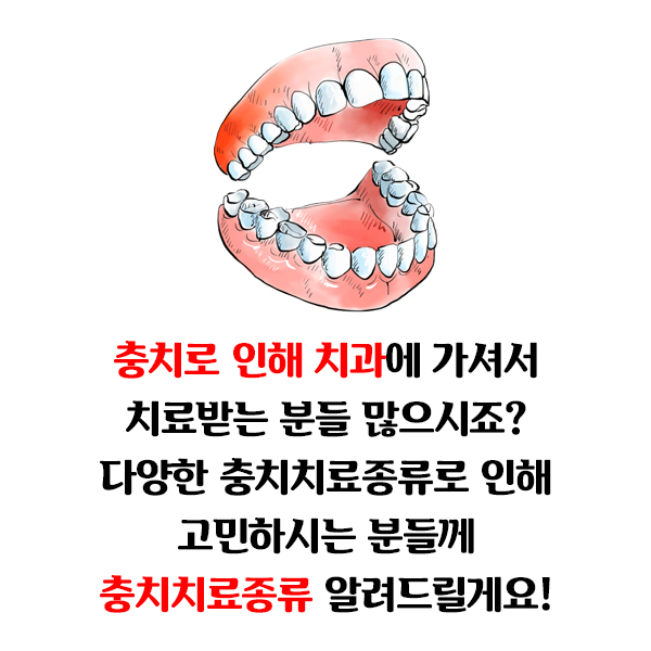 [충치치료종류] 충치치료 언제까지 참으실건가요?? 관련 이미지 4