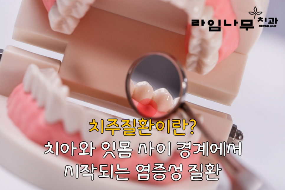 치주염 치은염 증상? 차이점 명동치과와 알아봐요! 관련 이미지 2