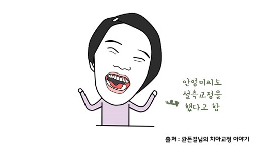 한 눈에 보는 치아교정 - 치아교정 장치의 종류 관련 이미지 10