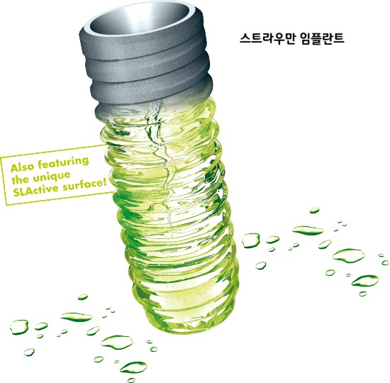 임플란트 이야기  VOL2 : 국산 임플란트와 외산임플란트의 차이 관련 이미지 3