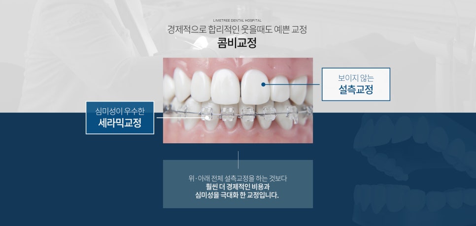 [명동 라임나무치과] 돌출입 교정, 눈에 띄지 않는 콤비교정으로 빠르게! 관련 이미지 3