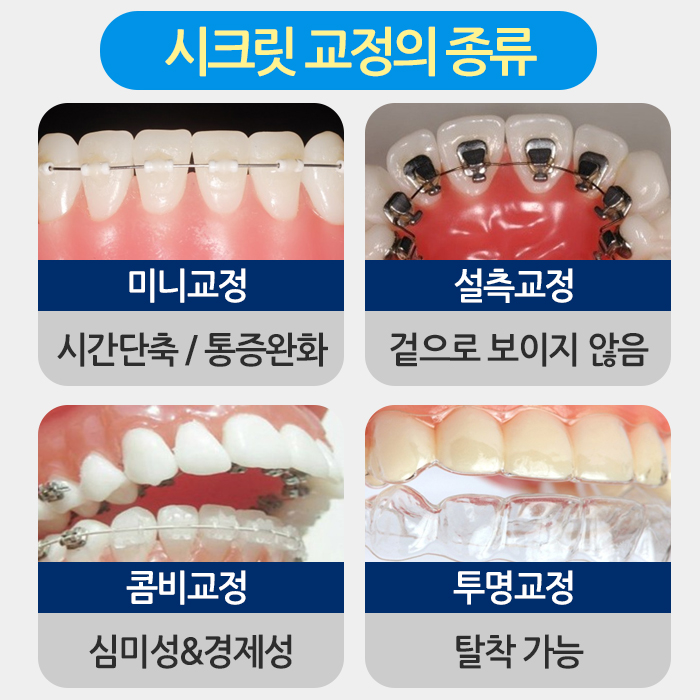 나에게 맞는 치아교정은? 관련 이미지 10