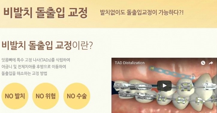 [명동치과]돌출입 때문에 고민중이시라고요? 라임나무에서 교정하세요 관련 이미지 4