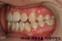 학생교정시 고려할 점은 무엇일까? 관련 이미지 2