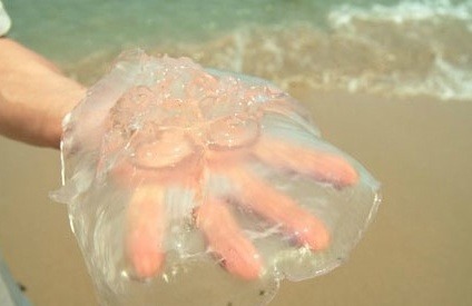 [명동치과 라임나무]해파리에 쏘였을 때 응급처치법을 알아보았습니다 관련 이미지 2