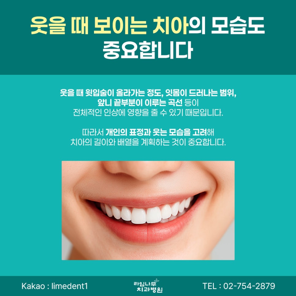 명동 라미네이트 전 꼭 확인해야 할 자연스러운 치아 디자인 기준 관련 이미지 5