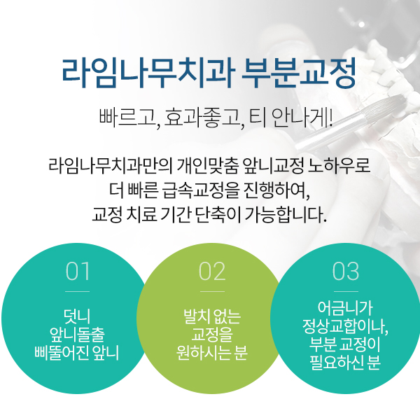 치아사이벌어짐, 라미네이트? 부분교정? 선택은! 관련 이미지 6