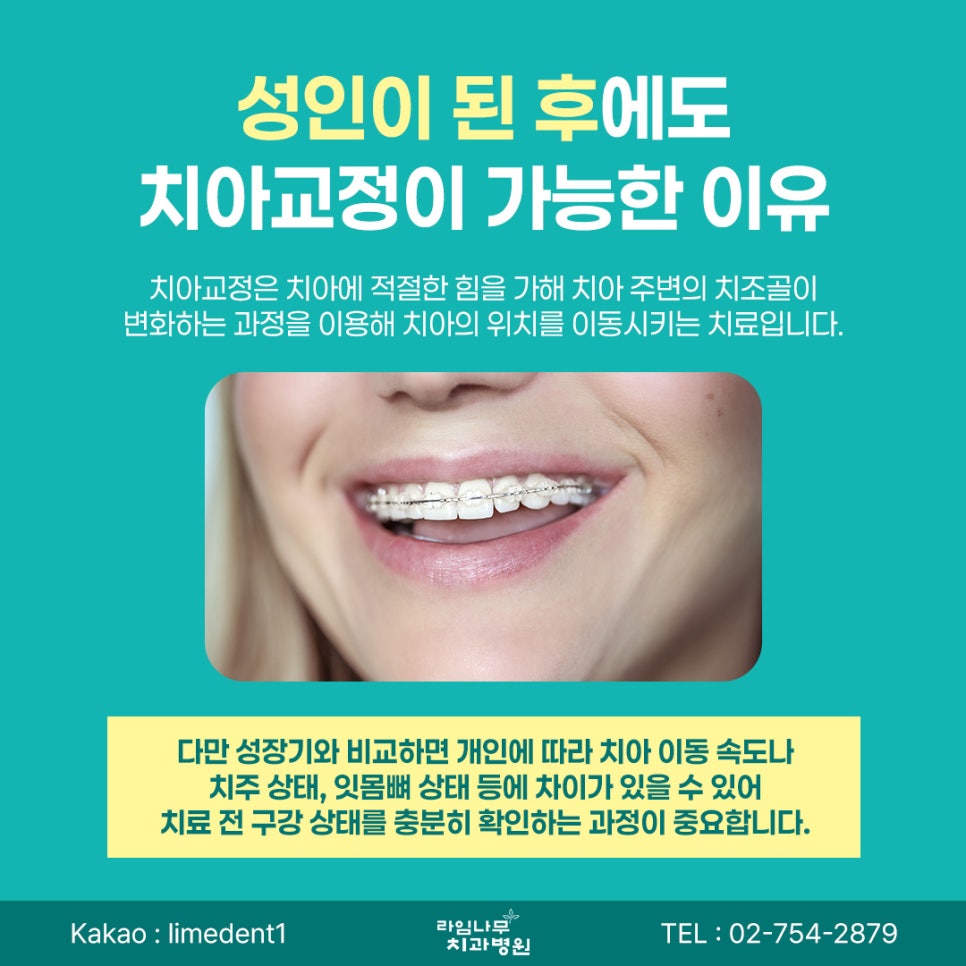 명동 치아교정 성인 치아교정, 나이가 많아도 시작할 수 있을까요? 관련 이미지 3