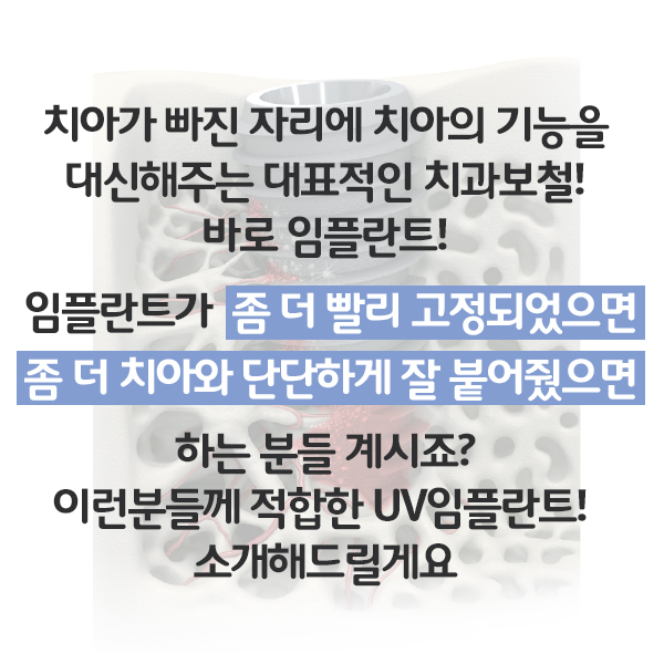 일반임플란트에 비해 안정적인 UV임플란트??? 빠른 골유착으로 바쁜 직장인들에게 딱이네요 관련 이미지 2