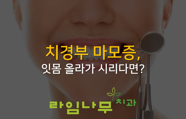 치경부마모증, 잇몸올라가 시리다면? 명동치과 라임나무 관련 이미지 1