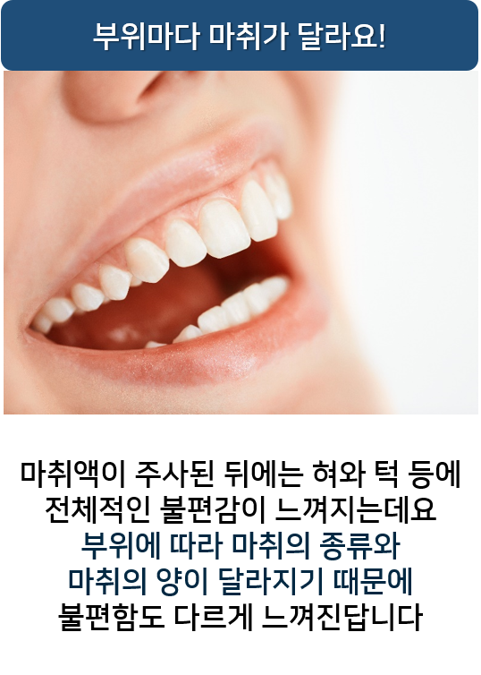 치과마취후 궁금한점? 주의사항과 부작용 알아보기 무통마취 명동치과 라임나무 관련 이미지 3