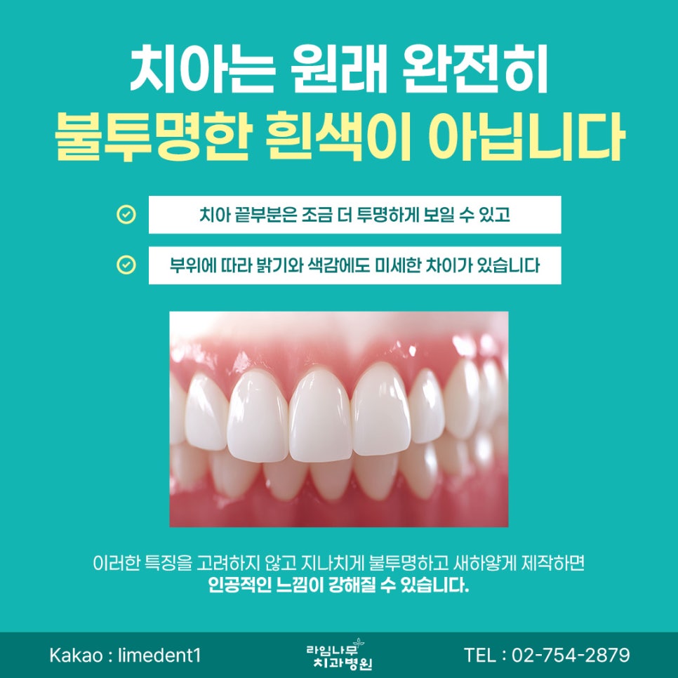 명동 라미네이트 라미네이트, 무조건 하얗게 하면 좋을까요? 자연스러운 색상을 고르는 기준 관련 이미지 5