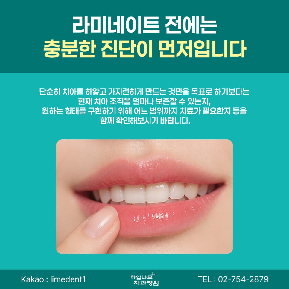 명동 라미네이트 라미네이트 전, 치아 삭제량이 걱정된다면 알아둘 점 관련 이미지 6