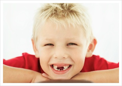 [궁금해요]임플란트의 수명, 얼마나 되나요? 관련 이미지 1