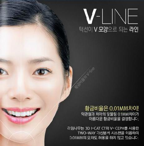 양악수술 말고 치아교정 하는 건 어떨까? 관련 이미지 5