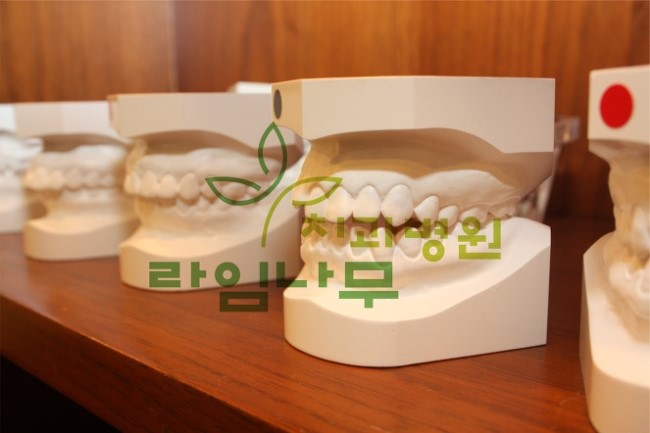 치아교정 전 진행하는 교정 진단과 검진의 차이점은? 관련 이미지 1