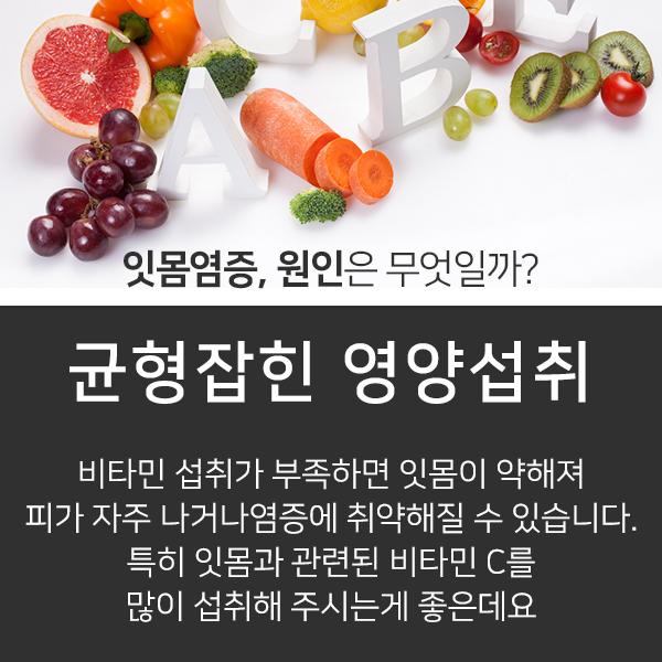 피곤하면 붓는 잇몸질환의 원인과 해결방법 관련 이미지 4