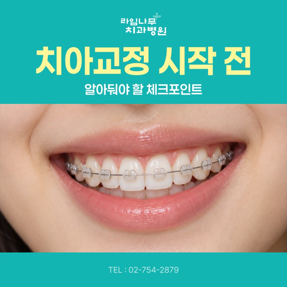 치아교정 시작 전, 알아둬야 할 체크포인트 관련 이미지 2