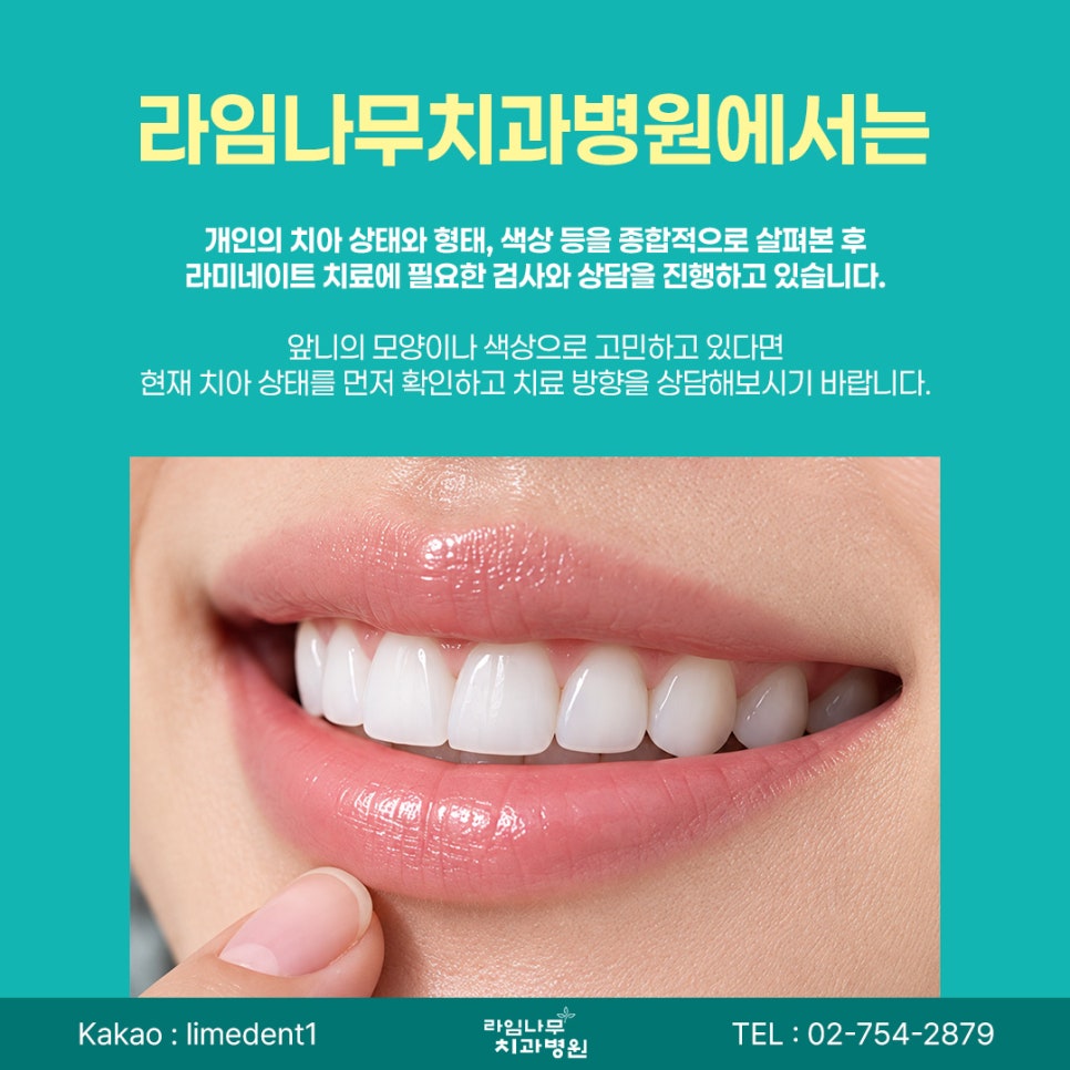 라미네이트 치료, 신중한 결정이 중요합니다 관련 이미지 10