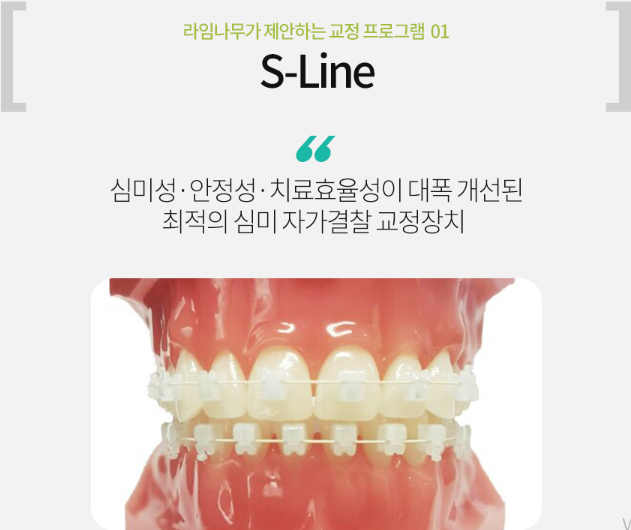 치아교정 장치 종류 (세라믹,클리피씨,에스라인교정) 관련 이미지 3