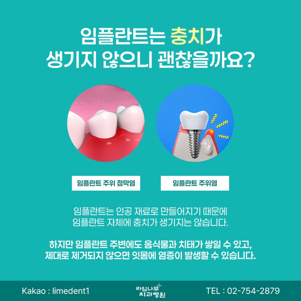 Why Aftercare Is More Important Than Implant Placement for Myeongdong Dental Implants image 3