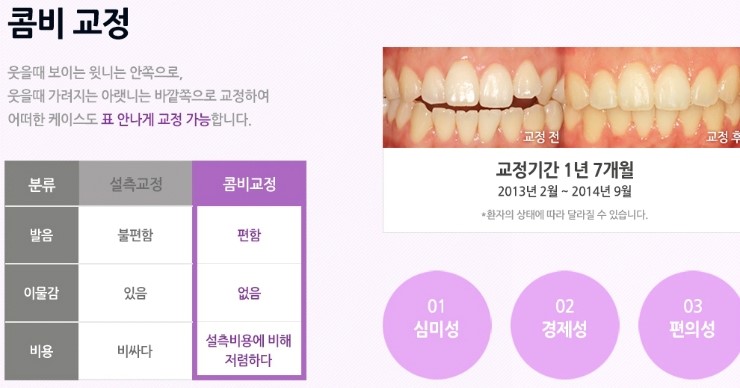 몰래 티 안나게 교정하고 싶은 마음, 시크릿 교정의 모든 것을 소개합니다 관련 이미지 7