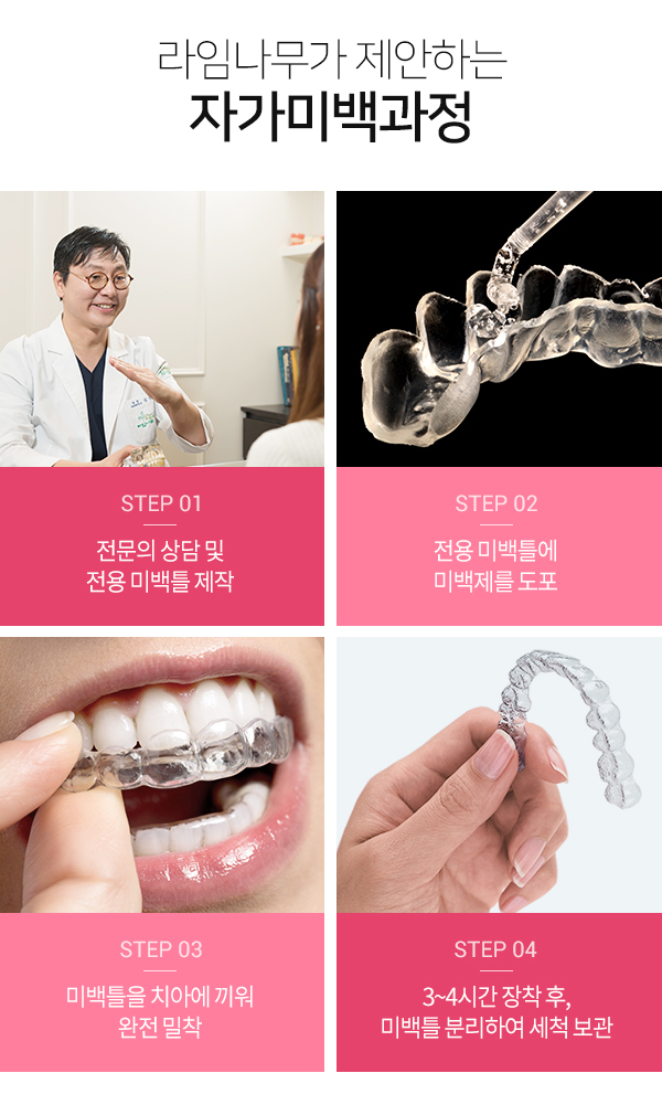 치아미백종류 환한 미소 기대해도 좋아 관련 이미지 7